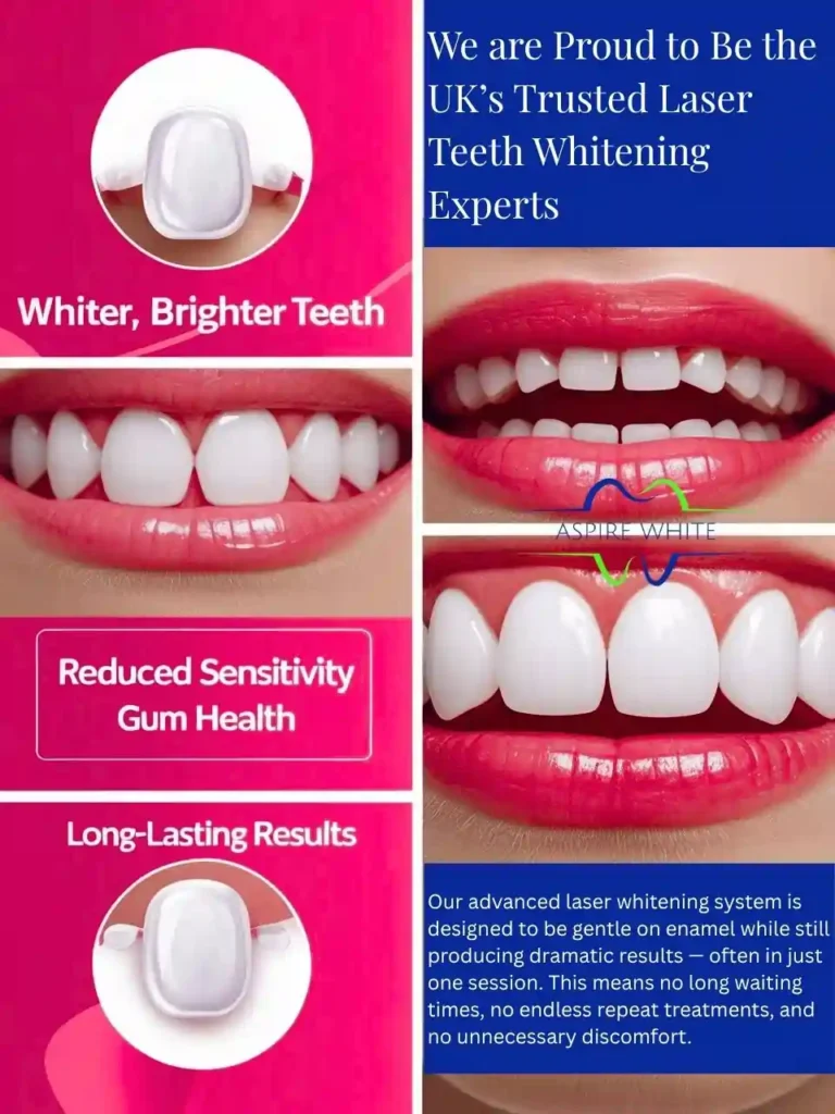 We are Proud to Be the UK’s Trusted Laser Teeth Whitening Experts Reigate